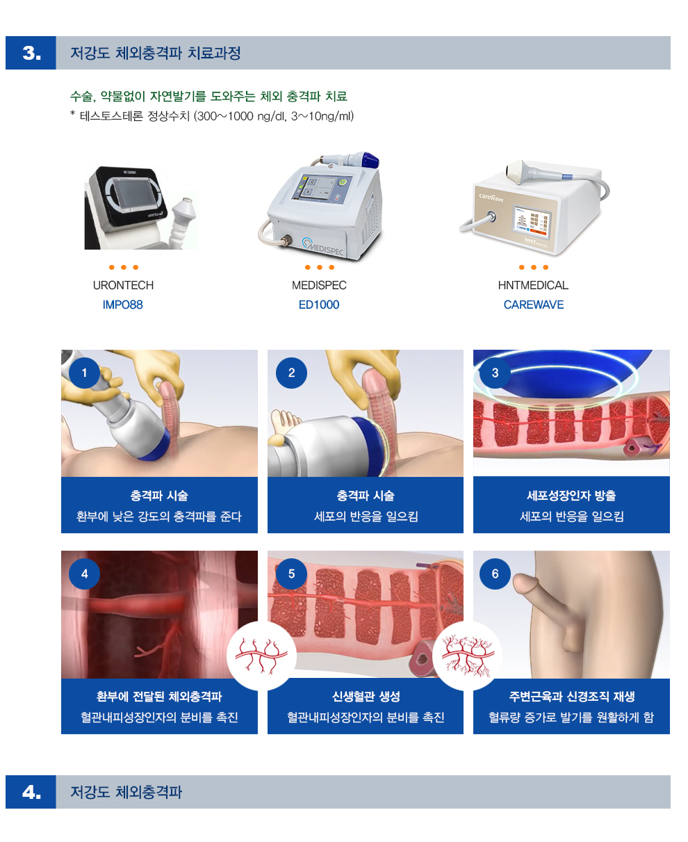 혈관재생 치료요법