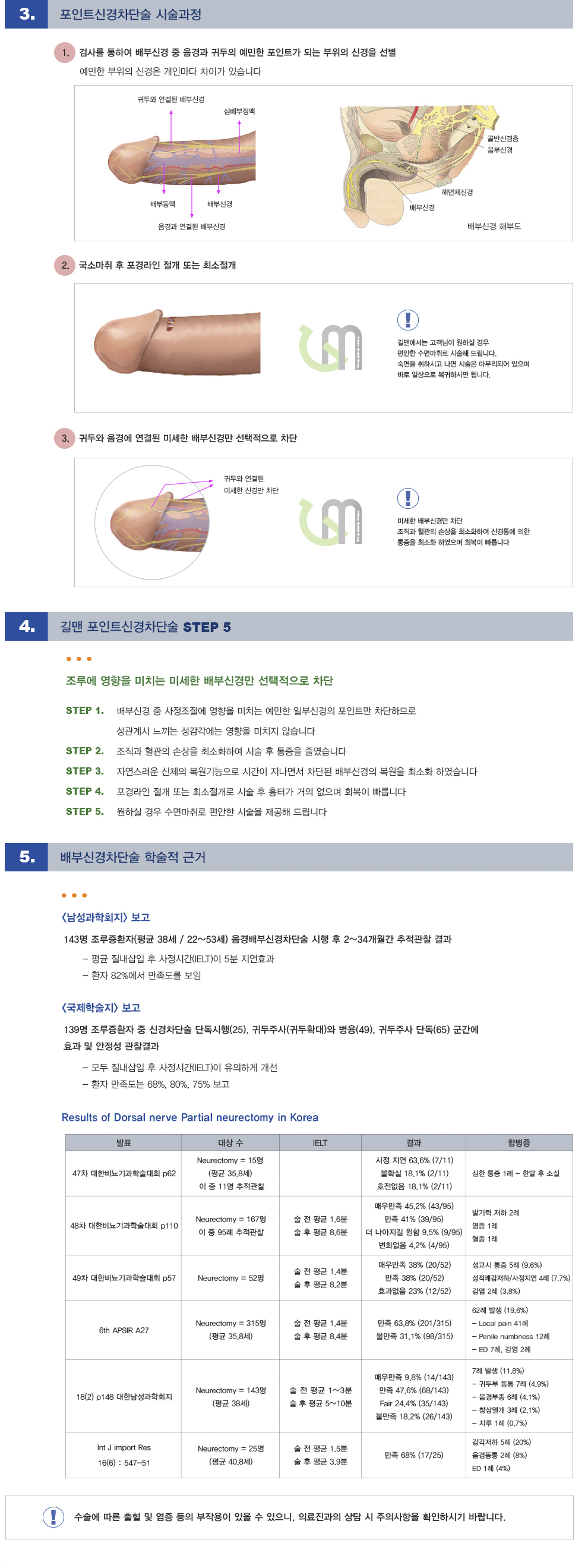 -포인트신경차단술